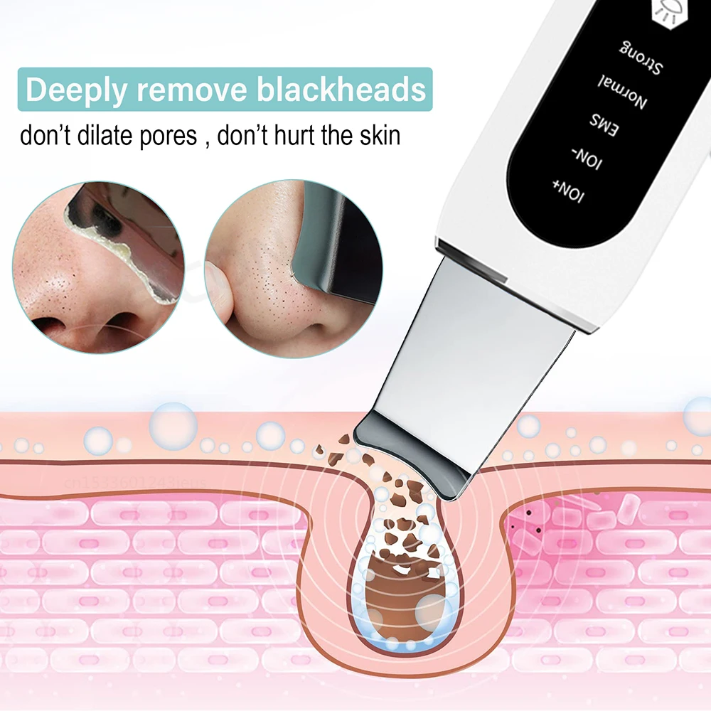 Ultrasonic-Skin-Scrubber-Peeling-Blackhead-Remover-Deep-Face-Cleaning-Ultrasonic-Ion-Ance-Pore-Cleaner-Facial-Shovel-3