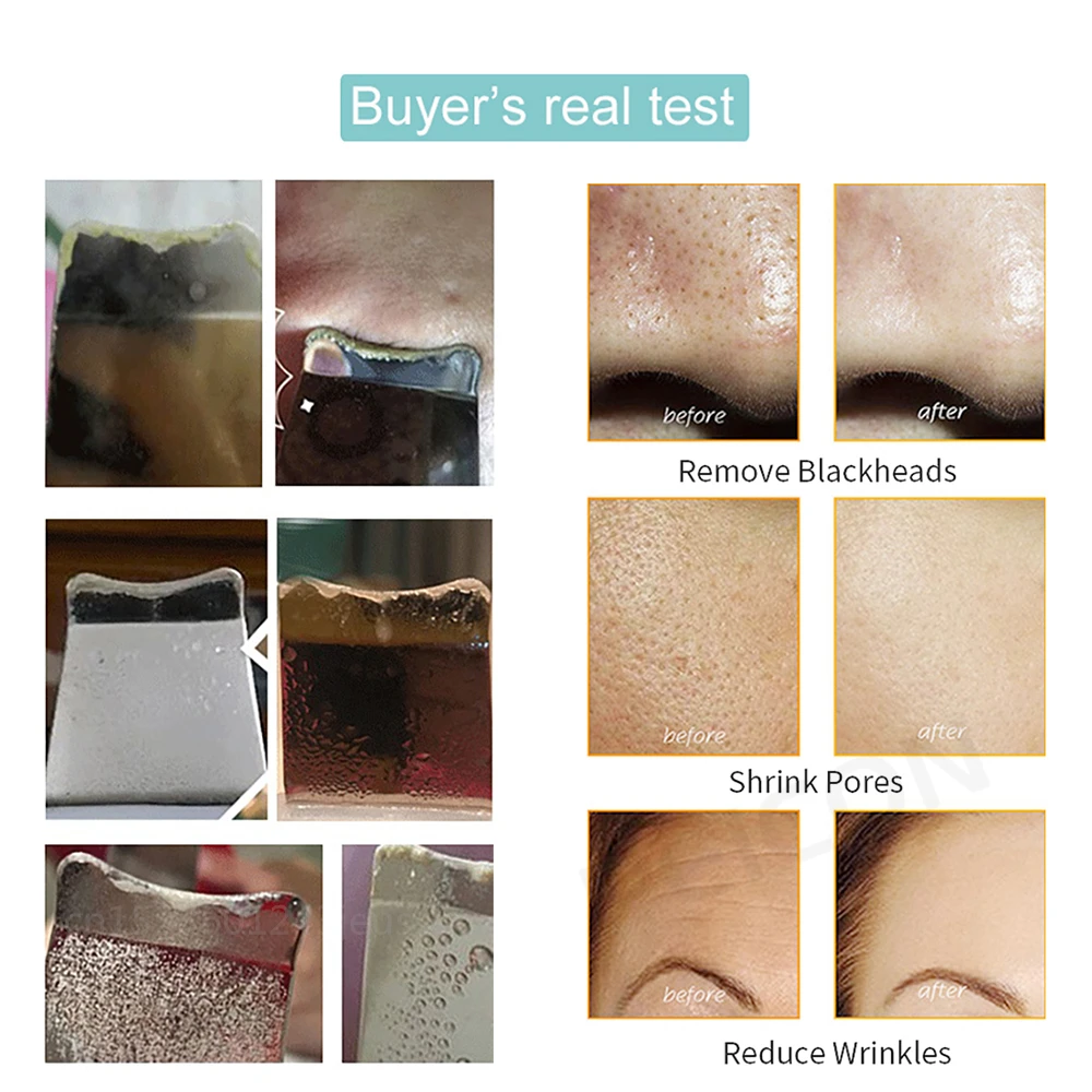 Ultrasonic-Skin-Scrubber-Peeling-Blackhead-Remover-Deep-Face-Cleaning-Ultrasonic-Ion-Ance-Pore-Cleaner-Facial-Shovel-5