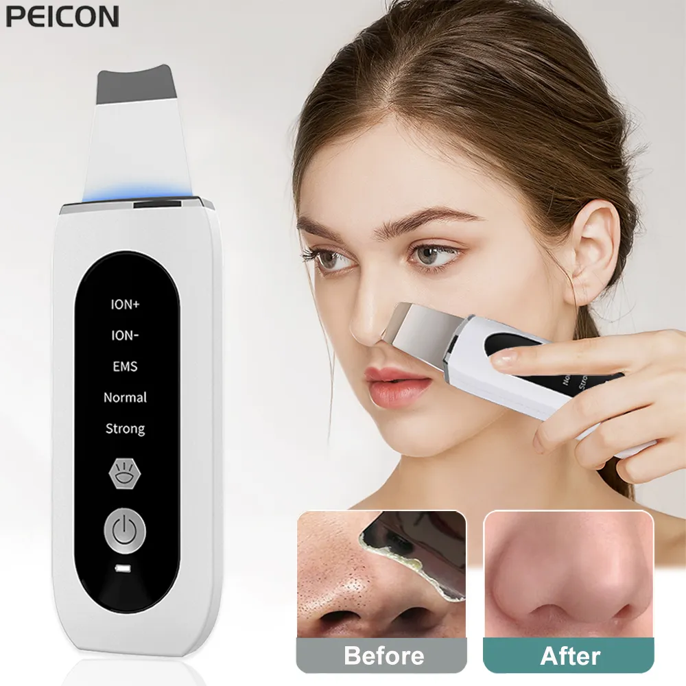 Ultrasonic-Skin-Scrubber-Peeling-Blackhead-Remover-Deep-Face-Cleaning-Ultrasonic-Ion-Ance-Pore-Cleaner-Facial-Shovel